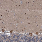 Anti-FLYWCH1 Antibody