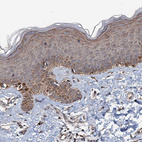 Immunohistochemical staining of human skin shows moderate cytoplasmic positivity in squamous epithelial cells.