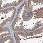Immunohistochemical staining of human prostate shows weak cytoplasmic positivity in glandular cells.