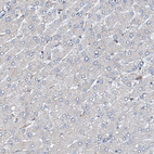 Immunohistochemical staining of human liver shows no positivity in hepatocytes as expected.