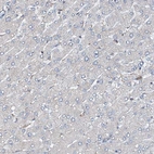 Immunohistochemical staining of human liver shows no positivity in hepatocytes as expected.