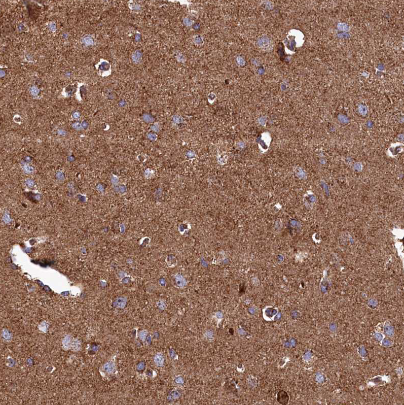 Anti-UBE3B Antibody