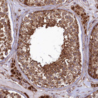 Immunohistochemical staining of human testis shows strong positivity in cytoplasm in cells in seminiferous ducts.