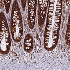 Immunohistochemical staining of human rectum shows strong positivity in cytoplasm in glandular cells.