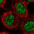 Immunofluorescent staining of human cell line A-431 shows localization to nuclear speckles.