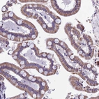 Immunohistochemical staining of human small intestine shows moderate granular cytoplasmic positivity in glandular cells.