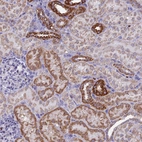 Immunohistochemical staining of human kidney shows strong granular cytoplasmic positivity in cells in tubules.
