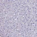 Immunohistochemical staining of human liver shows no positivity in hepatocytes as expected.