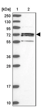 Lane 1: Marker [kDa] 250, 130, 95, 72, 55, 36, 28, 17, 10_br/_Lane 2: Human cell line RT-4