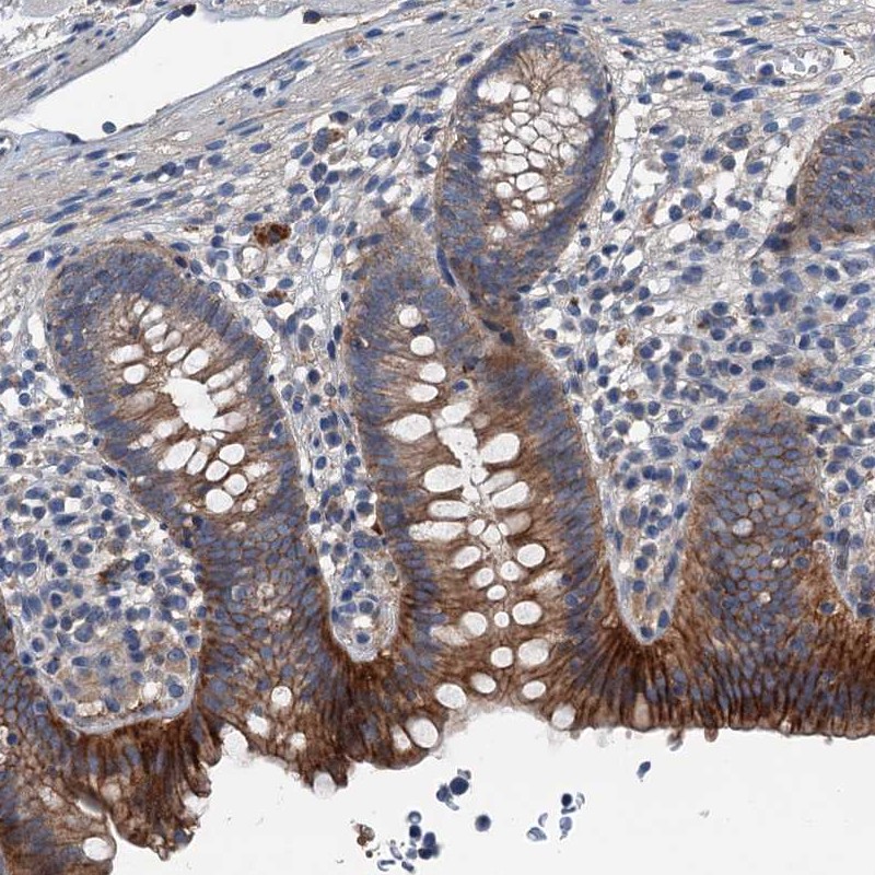 Anti-SLC2A10 Antibody