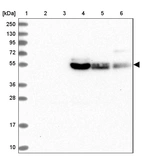 Lane 1: Marker [kDa] 250, 130, 95, 72, 55, 36, 28, 17, 10_br/_Lane 2: Human cell line RT-4_br/_Lane 3: Human cell line U-251MG sp_br/_Lane 4: Human plasma (IgG/HSA depleted)_br/_Lane 5: Human liver tissue_br/_Lane 6: Human tonsil tissue