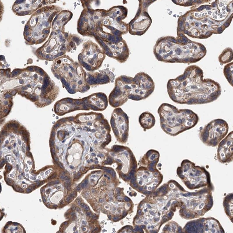 Anti-TLDC1 Antibody