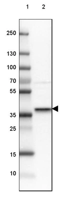 Lane 1: Marker [kDa] 250, 130, 100, 70, 55, 35, 25, 15, 10_br/_Lane 2: Human cell line MCF-7
