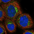Immunofluorescent staining of human cell line A-431 shows localization to vesicles.