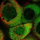 Immunofluorescent staining of human cell line A-431 shows localization to nucleoplasm & cytosol.