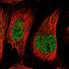 Immunofluorescent staining of human cell line U-2 OS shows localization to nucleoplasm.