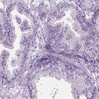 Immunohistochemical staining of human prostate shows low expression as expected.