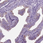 Immunohistochemical staining of human fallopian tube shows high expression.