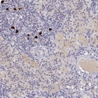 Immunohistochemical staining of human lymph node shows high expression.
