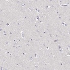 Immunohistochemical staining of human cerebral cortex shows low expression as expected.