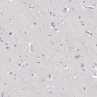 Immunohistochemical staining of human cerebral cortex shows low expression as expected.