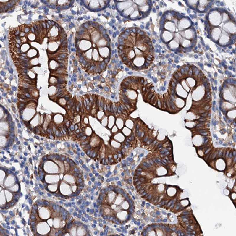 Anti-OTOL1 Antibody