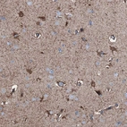 Anti-C1QTNF4 Antibody