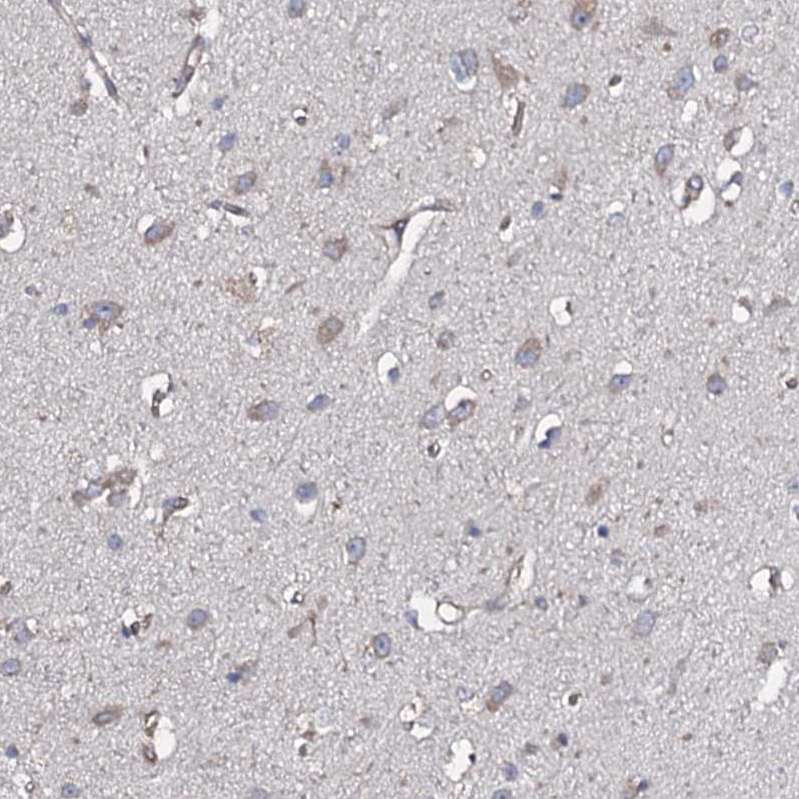 Anti-TMEM151A Antibody