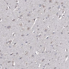 Anti-TMEM151A Antibody