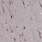 Immunohistochemical staining of human hippocampus shows moderate cytoplasmic-membranous positivity in neurons.