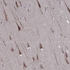 Immunohistochemical staining of human hippocampus shows moderate cytoplasmic-membranous positivity in neurons.