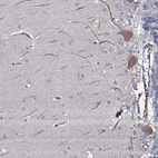 Immunohistochemical staining of human cerebellum shows moderate cytoplasmic-membranous positivity in Purkinje cells.