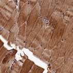 Immunohistochemical staining of human skeletal muscle shows strong cytoplasmic positivity in myocytes.