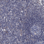 Anti-TMEM151A Antibody