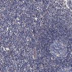 Immunohistochemical staining of human lymph node shows no positivity in non-germinal center cells and germinal center cells as expected.