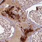 Immunohistochemical staining of human testis shows strong cytoplasmic positivity in Leydig cells.