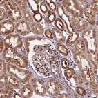 Immunohistochemical staining of human kidney shows strong cytoplasmic positivity in cells in tubules.