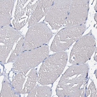 Immunohistochemical staining of human skeletal muscle shows no positivity in myocytes as expected.