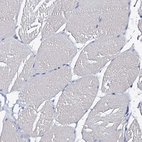 Immunohistochemical staining of human skeletal muscle shows no positivity in myocytes as expected.
