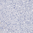 Anti-CSN2 Antibody