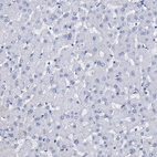 Immunohistochemical staining of human liver shows no positivity in hepatocytes as expected.