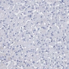 Immunohistochemical staining of human liver shows no positivity in hepatocytes as expected.
