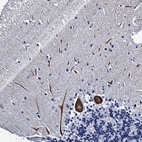 Anti-LRRC30 Antibody