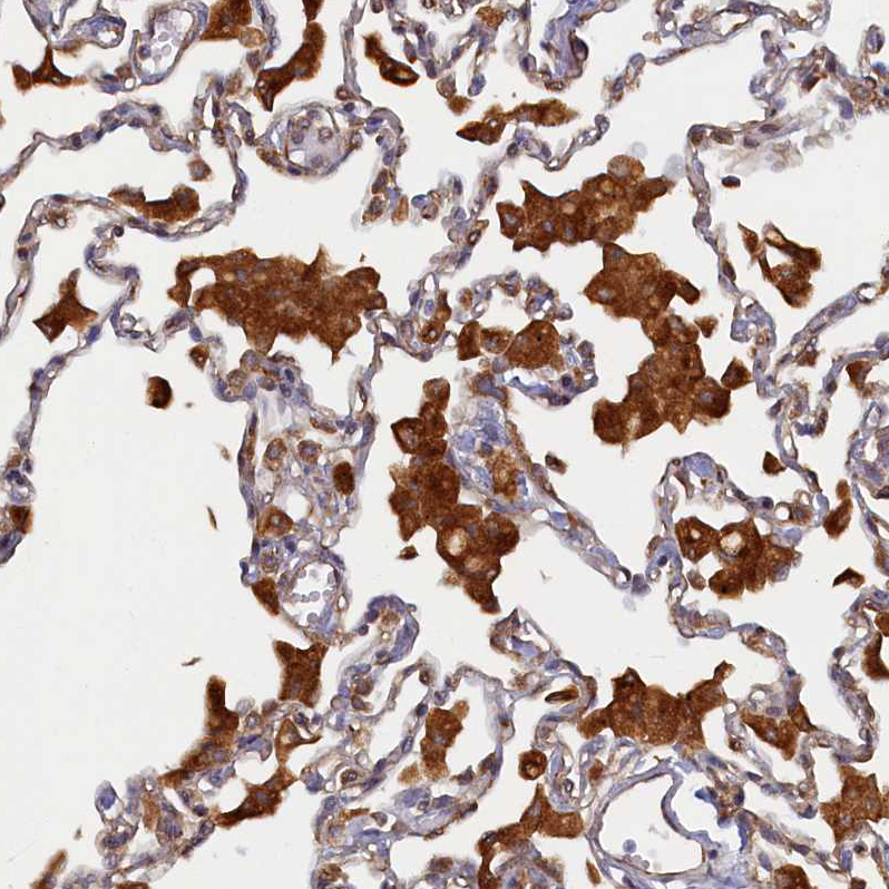 Anti-STX12 Antibody