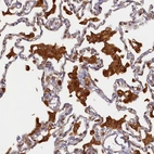 Anti-STX12 Antibody