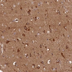 Immunohistochemical staining of human cerebral cortex shows strong cytoplasmic positivity in neurons.