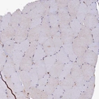 Immunohistochemical staining of human skeletal muscle shows no positivity in myocytes as expected.