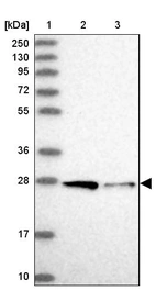 Lane 1: Marker [kDa] 250, 130, 95, 72, 55, 36, 28, 17, 10_br/_Lane 2: Human cell line RT-4_br/_Lane 3: Human cell line U-251MG sp
