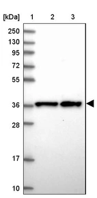 Lane 1: Marker [kDa] 250, 130, 95, 72, 55, 36, 28, 17, 10_br/_Lane 2: Human cell line RT-4_br/_Lane 3: Human cell line U-251MG sp