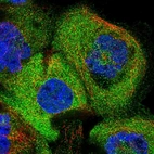 Immunofluorescent staining of human cell line A-431 shows localization to cytosol.